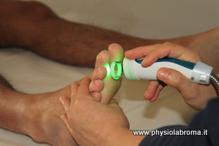 laserterapia del piede laser  acceso