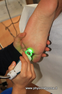 laserterapia del piede laser acceso
